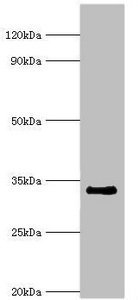 Western blot All lanes: Cell cycle checkpoint protein RAD1 antibody at 6ug/ml + NIH/3T3 whole cell lysate Secondary Goat polyclonal to rabbit IgG at 1/10000 dilution Predicted band size: 32, 28, 8 kDa Observed band size: 32 kDa