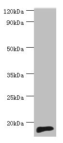 Western blot All lanes: TNNC2 antibody at 10ug/ml + Mouse skeletal muscle tissue Secondary Goat polyclonal to rabbit IgG at 1/10000 dilution Predicted band size: 18 kDa Observed band size: 18 kDa