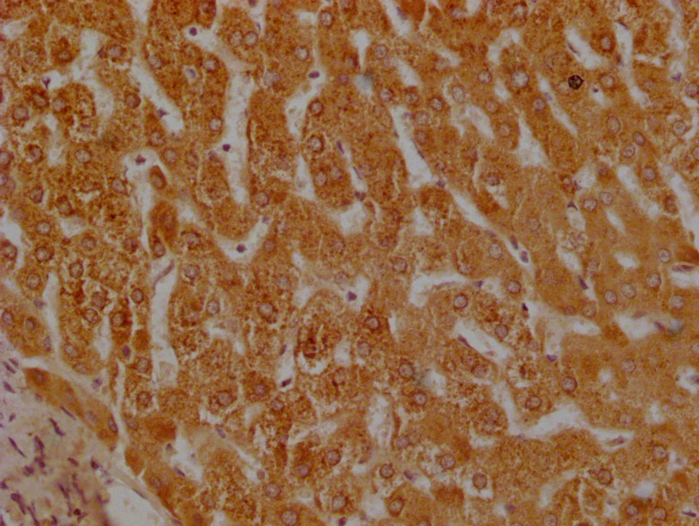 IHC image of CSB-PA025570LA01HU diluted at 1:200 and staining in paraffin-embedded human liver tissue performed on a Leica BondTM system. After dewaxing and hydration, antigen retrieval was mediated by high pressure in a citrate buffer (pH 6.0). Section was blocked with 10% normal goat serum 30min at RT. Then primary antibody (1% BSA) was incubated at 4°C overnight. The primary is detected by a Goat anti-rabbit polymer IgG labeled by HRP and visualized using 0.05% DAB.