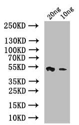 anti-Streptococcus pneumoniae psaA Antibody raised in - Cusabio