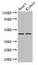 Western Blot Positive WB detected in: Mouse heart tissue, Mouse kidney tissue All lanes: NRXN1 antibody at 2ug/ml Secondary Goat polyclonal to rabbit IgG at 1/50000 dilution Predicted band size: 47, 51, 162, 165, 170, 16 kDa Observed band size: 47 kDa