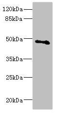 Western blot All lanes: COX10 antibody at 5.31ug/ml + Mouse gonadal tissue Secondary Goat polyclonal to rabbit IgG at 1/10000 dilution Predicted band size: 49, 28 kDa Observed band size: 49 kDa