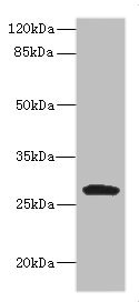 Western Blot Positive WB detected in: MCF7 whole cell lysate, JK whole cell lysate, Raji whole cell lysate, THP-1 whole cell lysate, K562 whole cell lysate,U937 whole cell lysate,Mouse Kidney tissue lysate All lanes: CLEC9A antibody at 1:1000 Secondary Goat polyclonal to rabbit IgG at 1/40000 dilution Predicted band size: 27 kDa Observed band size: 35 kDa