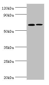 Western blot All lanes: IL27RA antibody at 9ug/ml Lane 1: Rat heart tissue Lane 2: Rat brain tissue Secondary Goat polyclonal to rabbit IgG at 1/10000 dilution Predicted band size: 69 kDa Observed band size: 69 kDa