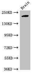 Western Blot Positive WB detected in: Mouse brain tissue All lanes: RBBP6 antibody at 2.7ug/ml Secondary Goat polyclonal to rabbit IgG at 1/50000 dilution Predicted band size: 202, 198, 14, 107 kDa Observed band size: 202 kDa