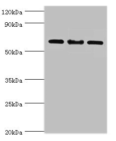 Western blot All lanes: IL22RA1 antibody at 10ug/ml Lane 1: Mouse spleen tissue Lane 2: HepG2 whole cell lysate Lane 3: 293T whole cell lysate Secondary Goat polyclonal to rabbit IgG at 1/10000 dilution Predicted band size: 63 kDa Observed band size: 63 kDa