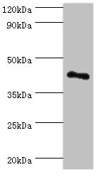 Western blot All lanes: RSAD2 antibody at 8ug/ml + Jurkat whole cell lysate Secondary Goat polyclonal to rabbit IgG at 1/10000 dilution Predicted band size: 42 kDa Observed band size: 42 kDa