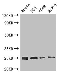 Western Blot Positive WB detected in: Mouse brain tissue, PC-3 whole cell lysate, A549 whole cell lysate, MCF-7 whole cell lysate All lanes: APOPT1 antibody at 2.7ug/ml Secondary Goat polyclonal to rabbit IgG at 1/50000 dilution predicted band size: 25 kDa observed band size: 25 kDa