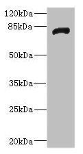 Western blot All lanes: HHIPantibody IgG at 1.92ug/ml + Rat heart tissue Secondary Goat polyclonal to rabbit IgG at 1/10000 dilution Predicted band size: 79, 37 kDa Observed band size: 79 kDa