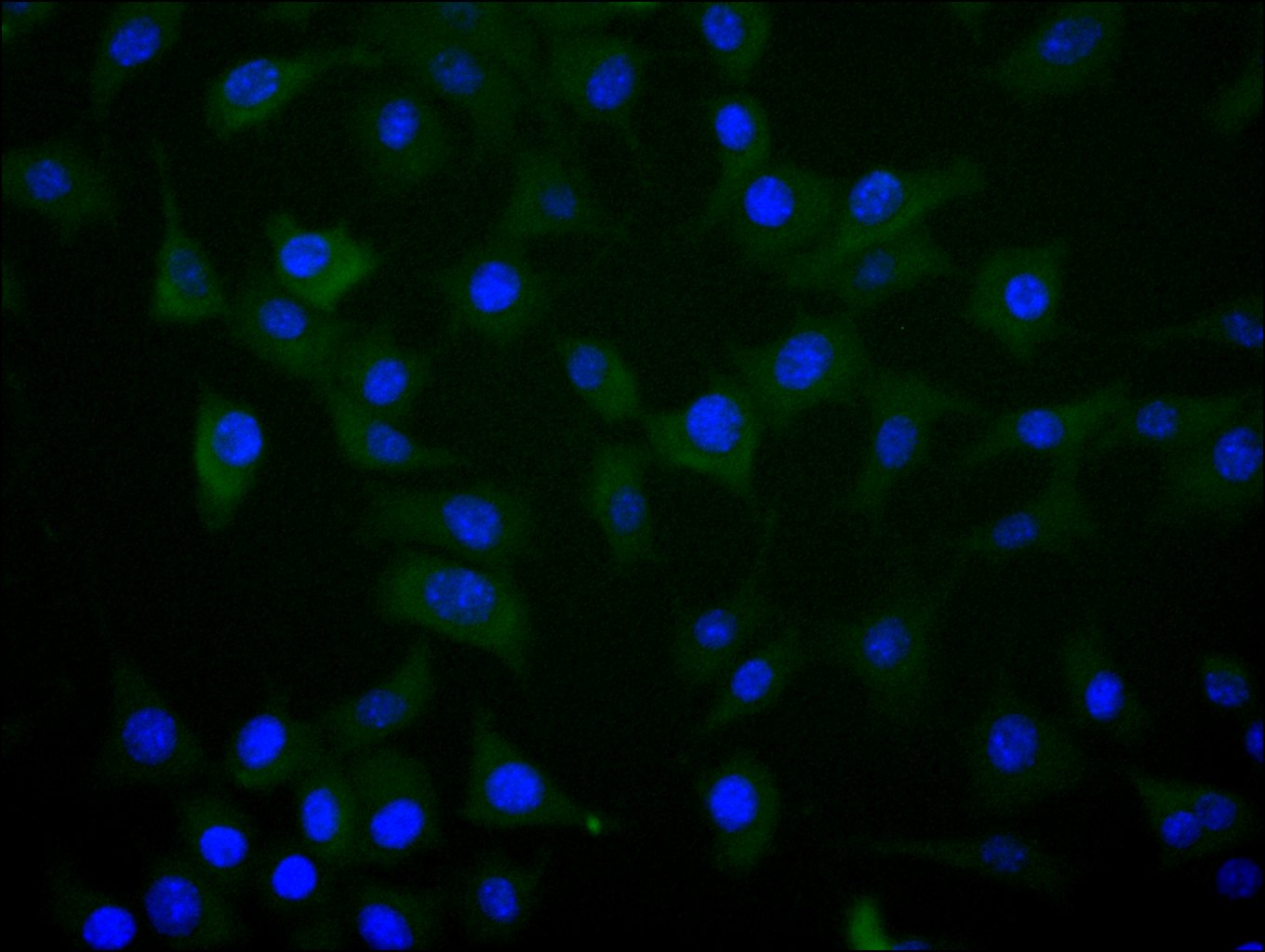 Immunofluorescence staining of SH-SY5Y cell with CSB-RA001950MA2HU at 1:20, counter-stained with DAPI. The cells were fixed in 4% formaldehyde and blocked in 10% normal Goat Serum. The cells were then incubated with the antibody overnight at 4C. The secondary antibody was FITC-conjugated AffiniPure Goat Anti-Human IgG(H+L).