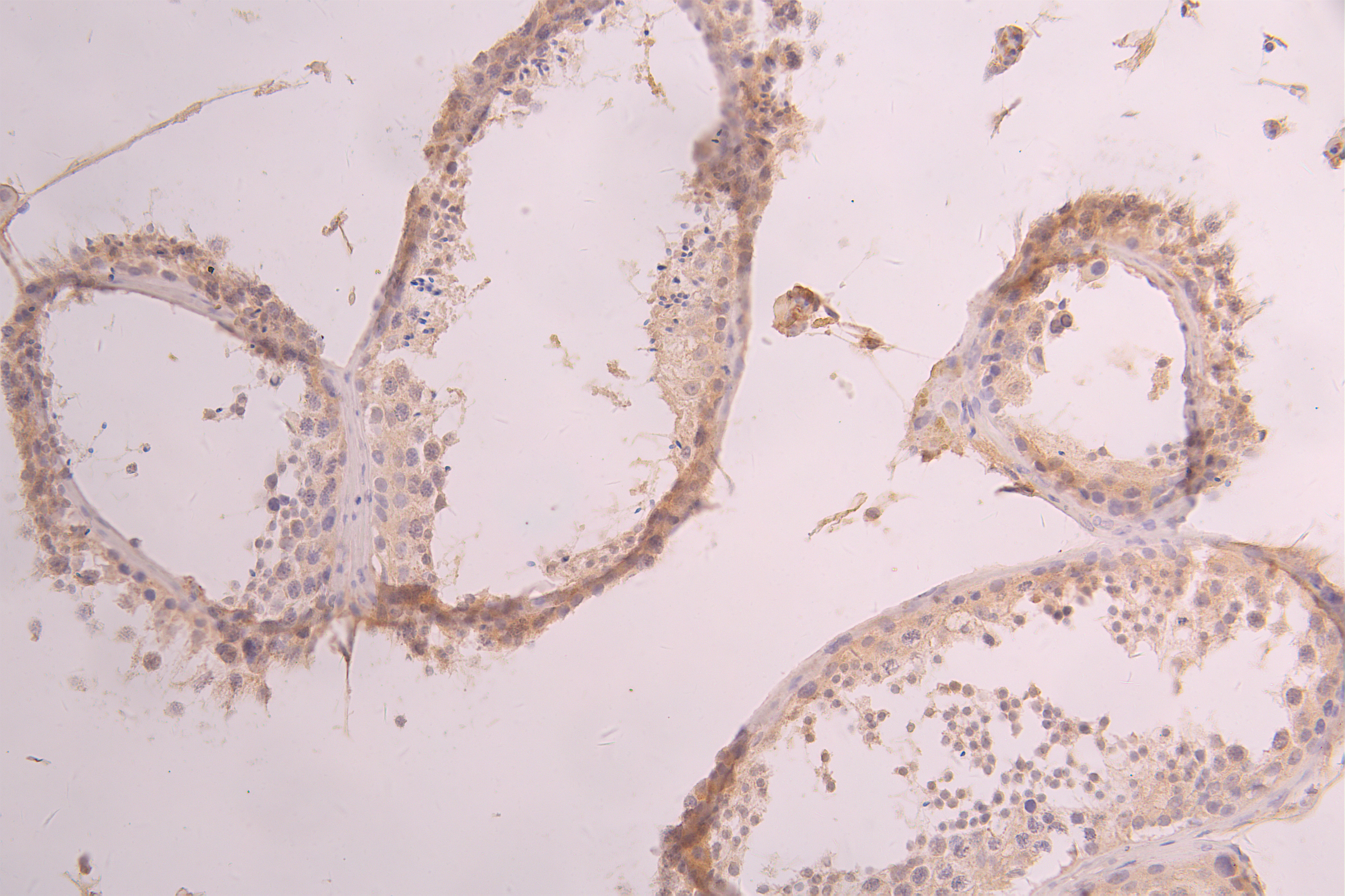 IHC image of CSB-RA001950MA2HU diluted at 1 : 50 and staining in paraffin-embedded human testis tissue performed on a Leica BondTM system. After dewaxing and hydration, antigen retrieval was mediated by high pressure in a citrate buffer (pH 6.0). Section was blocked with 10% normal goat serum 30min at RT. Then primary antibody (1% BSA) was incubated at 4°C overnight. The primary is detected by a Goat anti-human polymer IgG labeled by HRP and visualized using 0.05% DAB.