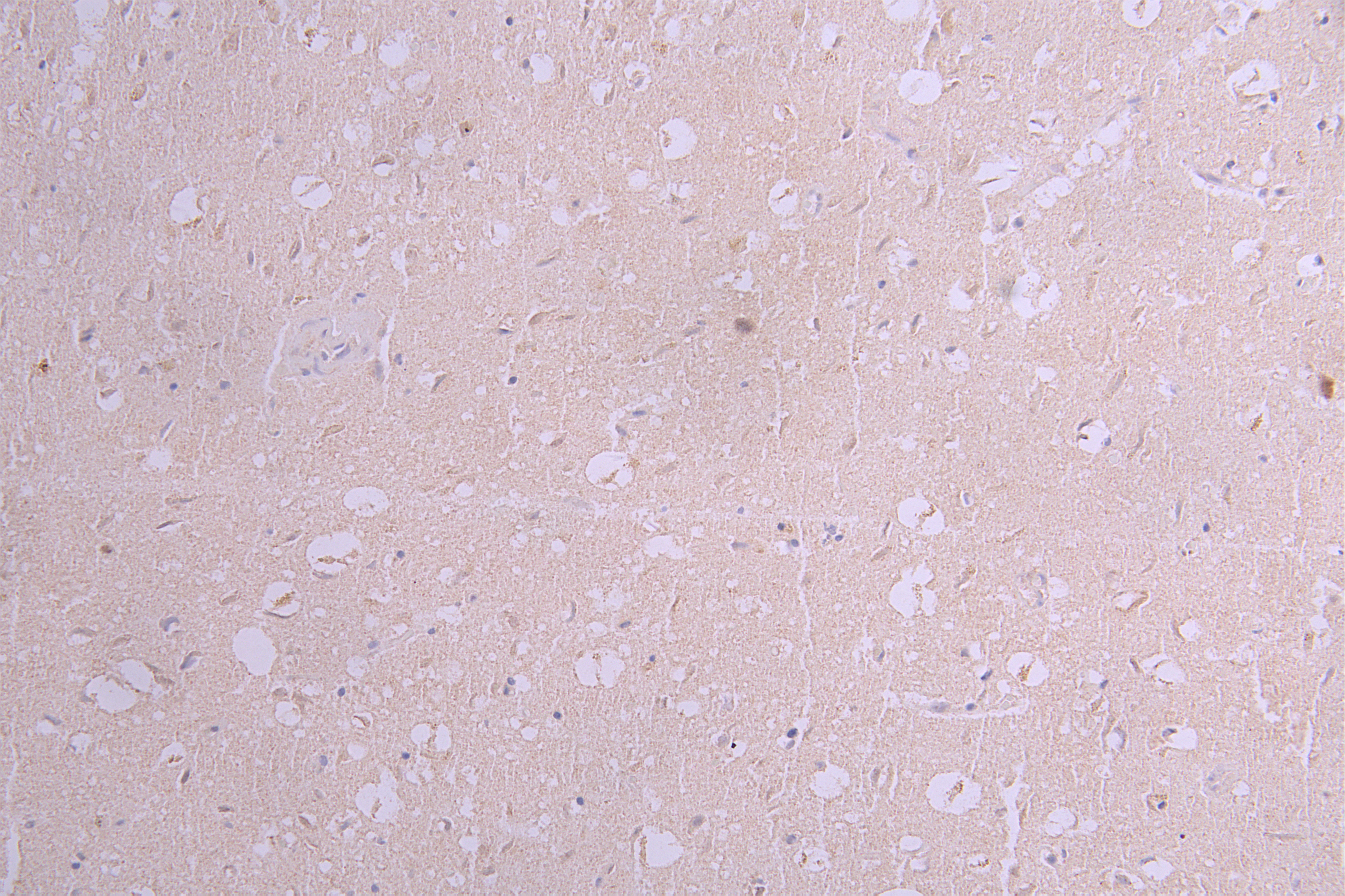 IHC image of CSB-RA001950MA2HU diluted at 1 : 50 and staining in paraffin-embedded human brain tissue performed on a Leica BondTM system. After dewaxing and hydration, antigen retrieval was mediated by high pressure in a citrate buffer (pH 6.0). Section was blocked with 10% normal goat serum 30min at RT. Then primary antibody (1% BSA) was incubated at 4°C overnight. The primary is detected by a Goat anti-human polymer IgG labeled by HRP and visualized using 0.05% DAB.