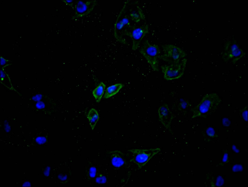 Immunofluorescence staining of Hela cell with CSB-RA002415MA1HU at 1:100, counter-stained with DAPI. The cells were fixed in 4% formaldehyde and blocked in 10% normal Goat Serum. The cells were then incubated with the antibody overnight at 4C. The secondary antibody was Alexa Fluor 488-congugated AffiniPure Goat Anti-Rabbit IgG(H+L).