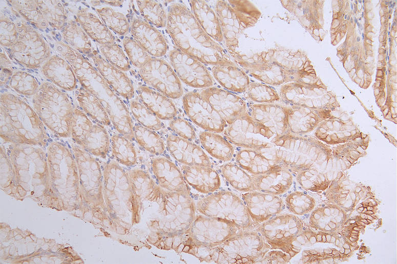 IHC image of CSB-RA003656A0HU diluted at 1:100 and staining in paraffin-embedded human stomach tissue performed on a Leica BondTM system. After dewaxing and hydration, antigen retrieval was mediated by high pressure in a citrate buffer (pH 6.0). Section was blocked with 10% normal goat serum 30min at RT. Then primary antibody (1% BSA) was incubated at 4°C overnight. The primary is detected by a Goat anti-rabbit polymer IgG labeled by HRP and visualized using 0.18% DAB.