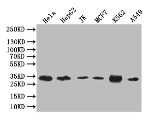 Western Blot Positive WB detected in: Hela whole cell lysate, HepG2 whole cell lysate, JK whole cell lysate, MCF7 whole cell lysate, K562 whole cell lysate, A549 whole cell lysate All lanes: Caspase 3 antibody at 1:1000 Secondary Goat polyclonal to rabbit IgG at 1/50000 dilution Predicted band size: 32 kDa Observed band size: 32 kDa