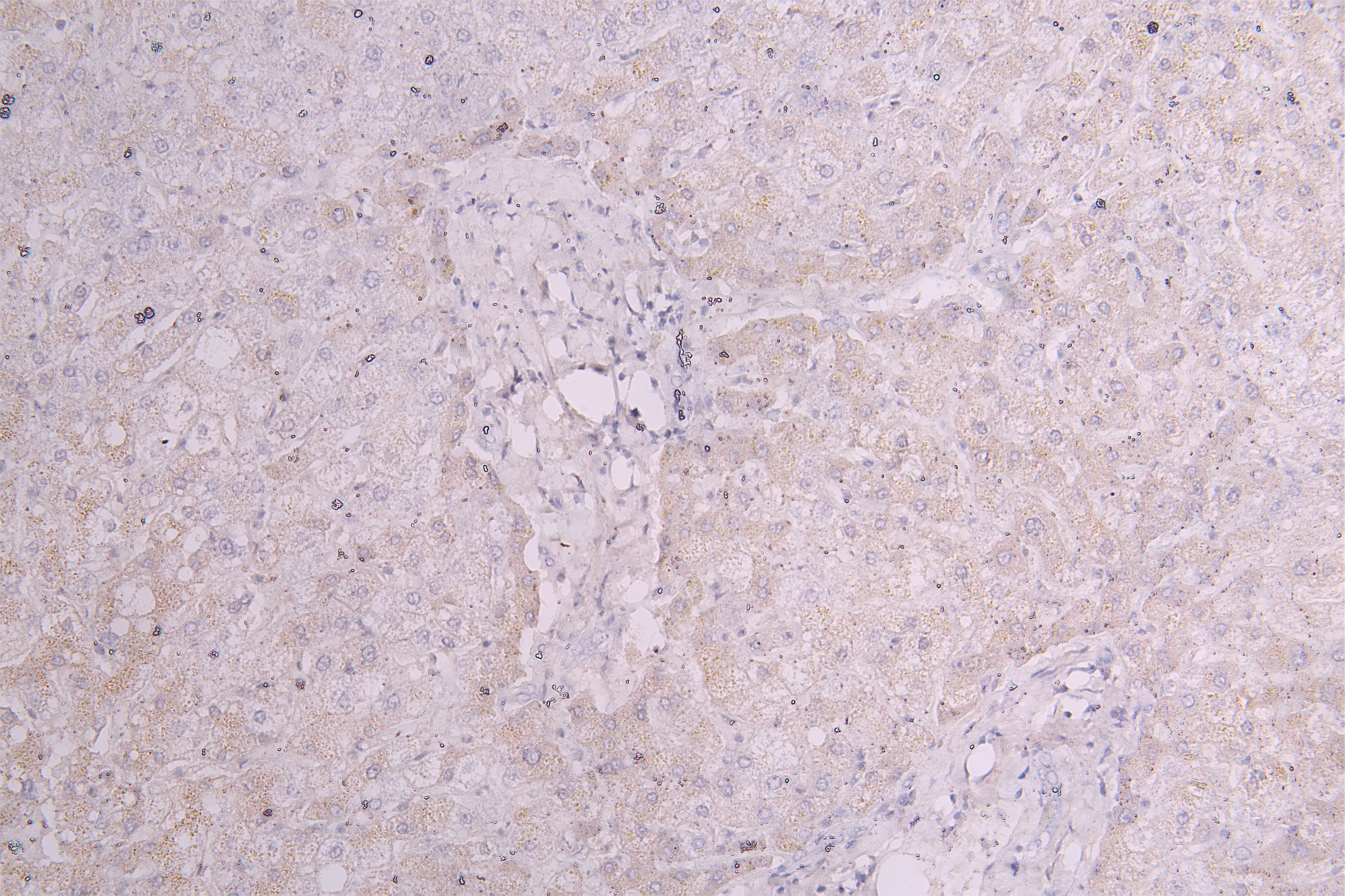 IHC image of CSB-RA003657MA1HU diluted at 1:100 and staining in paraffin-embedded human liver tissue performed on a Leica BondTM system. After dewaxing and hydration, antigen retrieval was mediated by high pressure in a citrate buffer (pH 6.0). Section was blocked with 10% normal goat serum 30min at RT. Then primary antibody (1% BSA) was incubated at 4°C overnight. The primary is detected by a Goat anti-Human IgG labeled by HRP and visualized using 0.05% DAB.