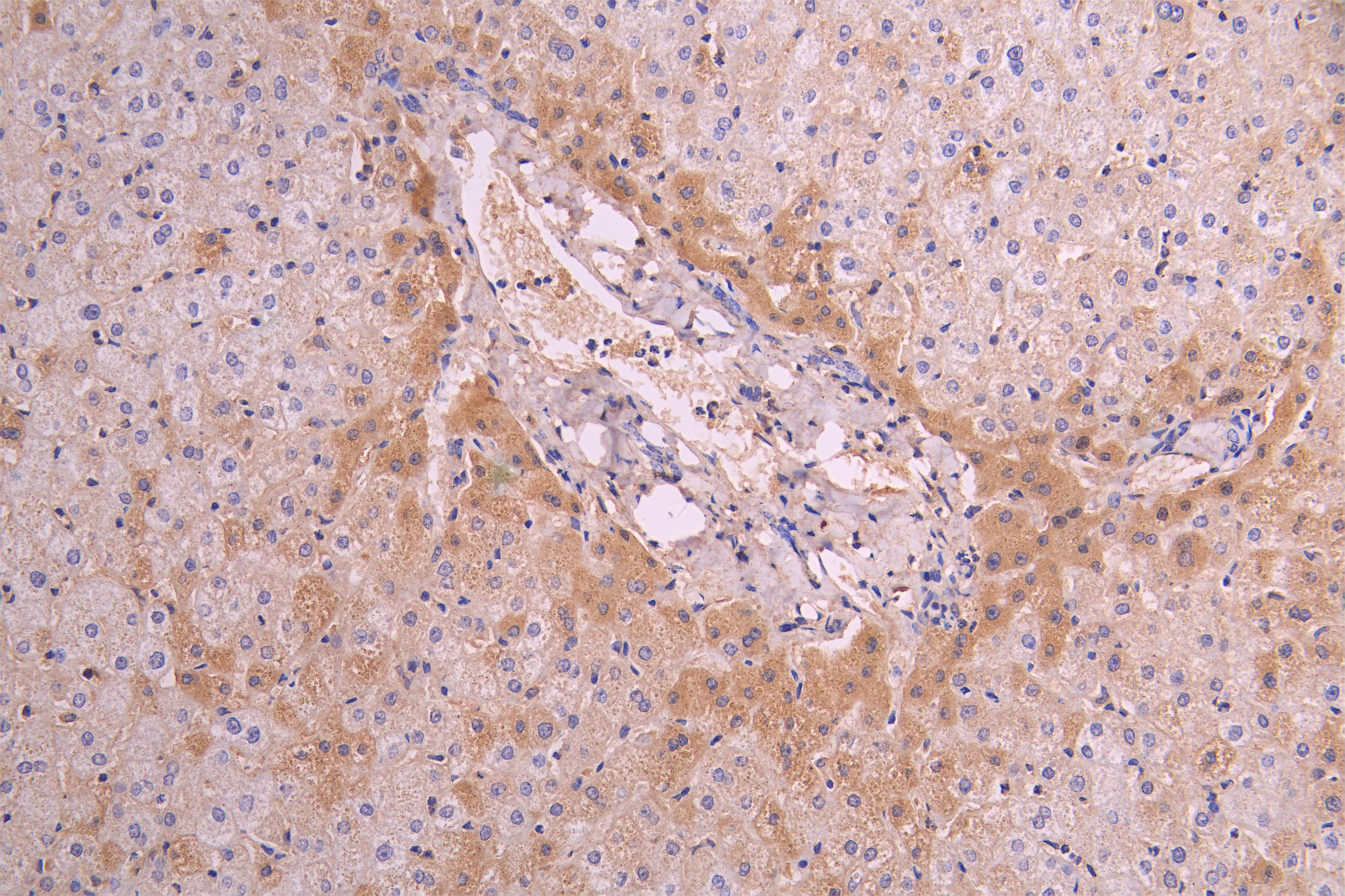 IHC image of CSB-RA004879MA1HU diluted at 1 : 100 and staining in paraffin-embedded human liver tissue performed on a Leica BondTM system. After dewaxing and hydration, antigen retrieval was mediated by high pressure in a citrate buffer (pH 6.0). Section was blocked with 10% normal goat serum 30min at RT. Then primary antibody (1% BSA) was incubated at 4°C overnight. The primary is detected by a Goat anti-human polymer IgG labeled by HRP and visualized using 0.05% DAB.