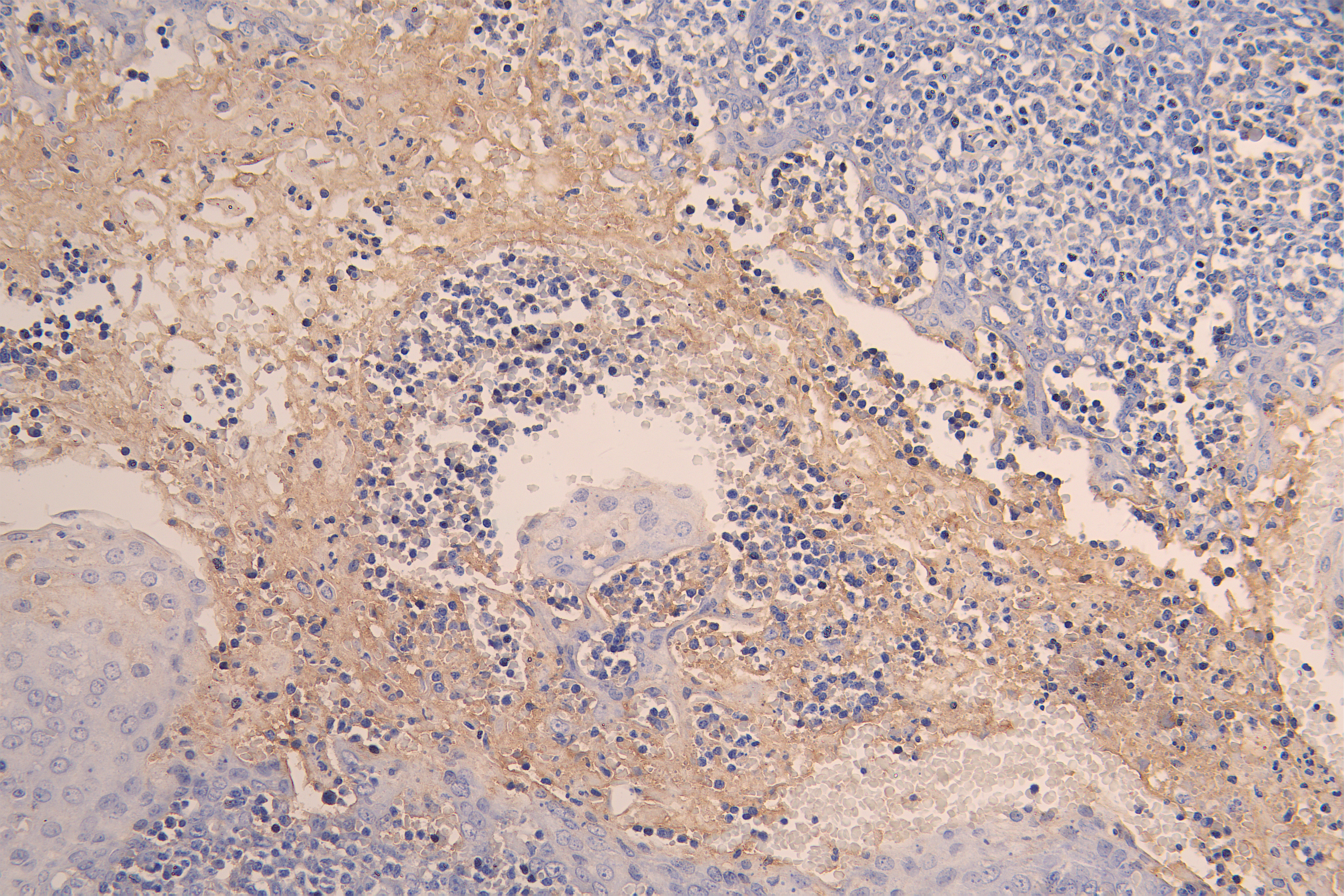 IHC image of CSB-RA004928MA1HU diluted at 1:200 and staining in paraffin-embedded human tonsil tissue performed on a Leica BondTM system. After dewaxing and hydration, antigen retrieval was mediated by high pressure in a citrate buffer (pH 6.0). Section was blocked with 10% normal goat serum 30min at RT. Then primary antibody (1% BSA) was incubated at 4°C overnight. The primary is detected by a Goat anti-human polymer IgG labeled by HRP and visualized using 0.05% DAB.