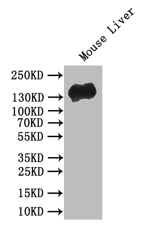 Western Blot Positive WB detected in: Mouse Liver tissue lysate All lanes: CDH1 antibody at 1:500 Secondary Goat polyclonal to mouse IgG at 1/50000 dilution Predicted band size: 80-135 kDa Observed band size: 135 kDa