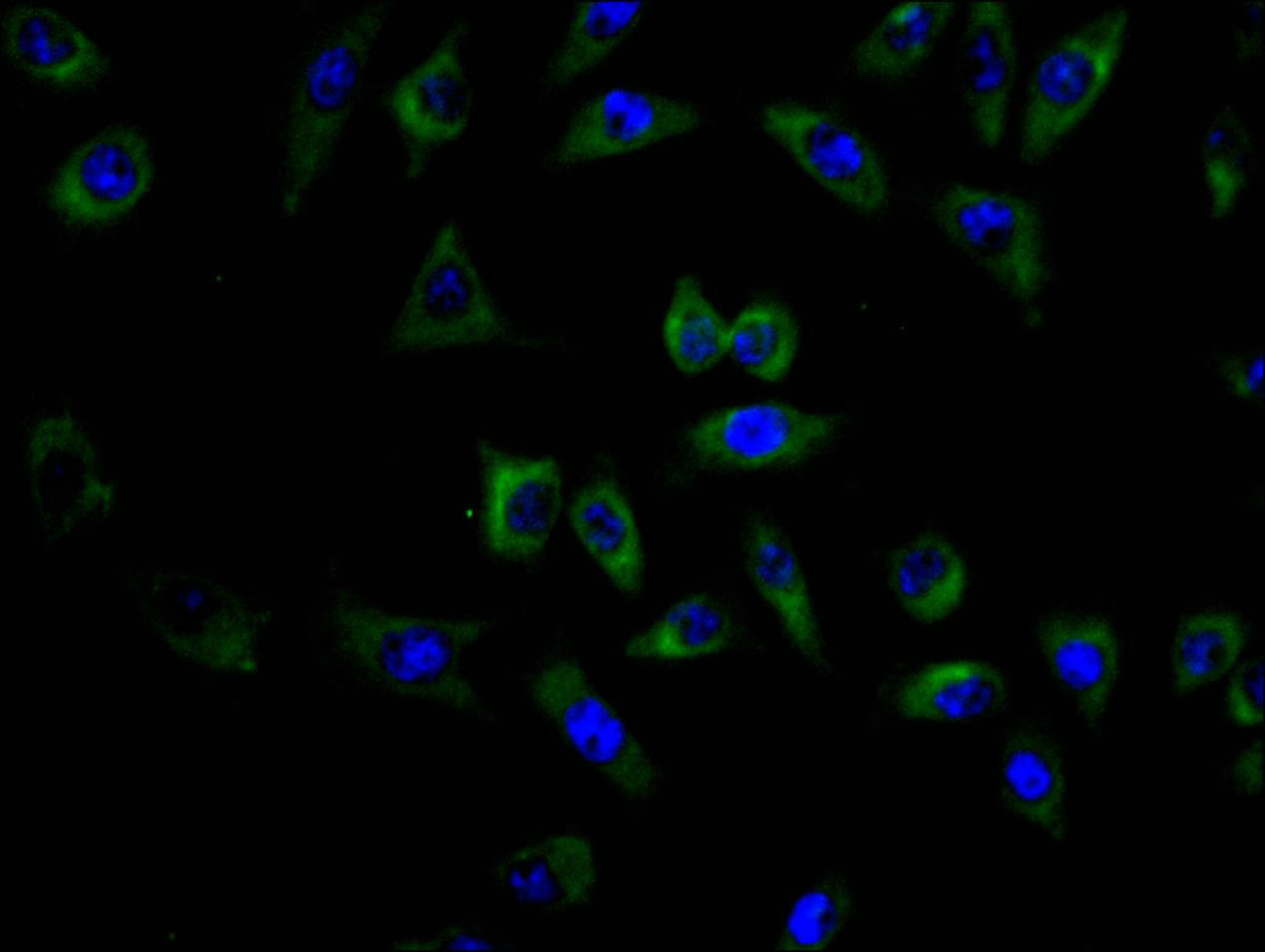 Immunofluorescence staining of MCF7 cell with CSB-RA005165MA3HU at 1:150, counter-stained with DAPI. The cells were fixed in 4% formaldehyde and blocked in 10% normal Goat Serum. The cells were then incubated with the antibody overnight at 4C. The secondary antibody was FITC-conjugated AffiniPure Goat Anti-human IgG(H+L).