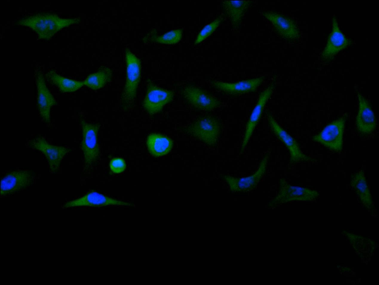 Immunofluorescence staining of MCF7 cell with CSB-RA006169MA1HU at 1:200, counter-stained with DAPI. The cells were fixed in 4% formaldehyde and blocked in 10% normal Goat Serum. The cells were then incubated with the antibody overnight at 4C. The secondary antibody was Alexa Fluor 488-congugated AffiniPure Goat Anti-rabbit IgG(H+L).