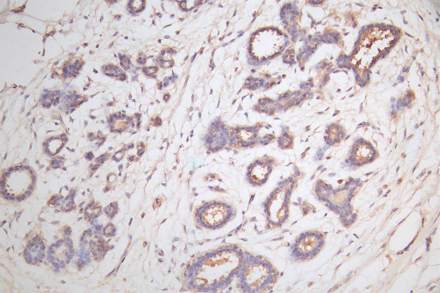 IHC image of CSB-RA006169MA1HU diluted at 1:100 and staining in paraffin-embedded human breast tissue performed on a Leica BondTM system. After dewaxing and hydration, antigen retrieval was mediated by high pressure in a citrate buffer (pH 6.0). Section was blocked with 10% normal goat serum 30min at RT. Then primary antibody (1% BSA) was incubated at 4°C overnight. The primary is detected by a Goat anti-rabbit polymer IgG labeled by HRP and visualized using 0.05% DAB.