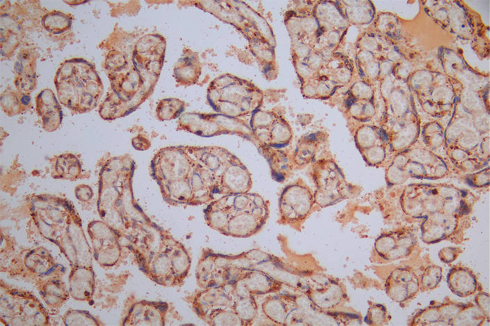 IHC image of CSB-RA006193MA1HU diluted at 1:30 and staining in paraffin-embedded human placenta tissue performed on a Leica BondTM system. After dewaxing and hydration, antigen retrieval was mediated by high pressure in a citrate buffer (pH 6.0). Section was blocked with 10% normal goat serum 30min at RT. Then primary antibody (1% BSA) was incubated at 4°C overnight. The primary is detected by a Goat anti-Mouse IgG labeled by HRP and visualized using 0.05% DAB.