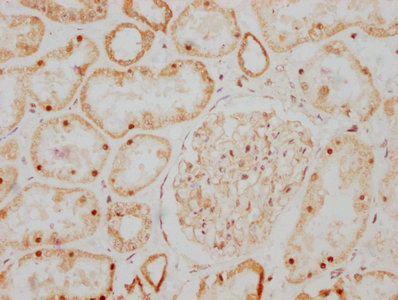 IHC image of CSB-RA009356A0HU diluted at 1:107.5 and staining in paraffin-embedded human kidney tissue performed on a Leica BondTM system. After dewaxing and hydration, antigen retrieval was mediated by high pressure in a citrate buffer (pH 6.0). Section was blocked with 10% normal goat serum 30min at RT. Then primary antibody (1% BSA) was incubated at 4°C overnight. The primary is detected by a biotinylated secondary antibody and visualized using an HRP conjugated SP system.