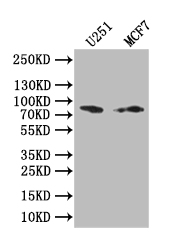 Western Blot Positive WB detected in: U251 whole cell lysate, MCF7 whole cell lysate All lanes: GSN antibody at 1:1000 Secondary Goat polyclonal to rabbit IgG at 1/50000 dilution Predicted band size: 85 kDa Observed band size: 85 kDa