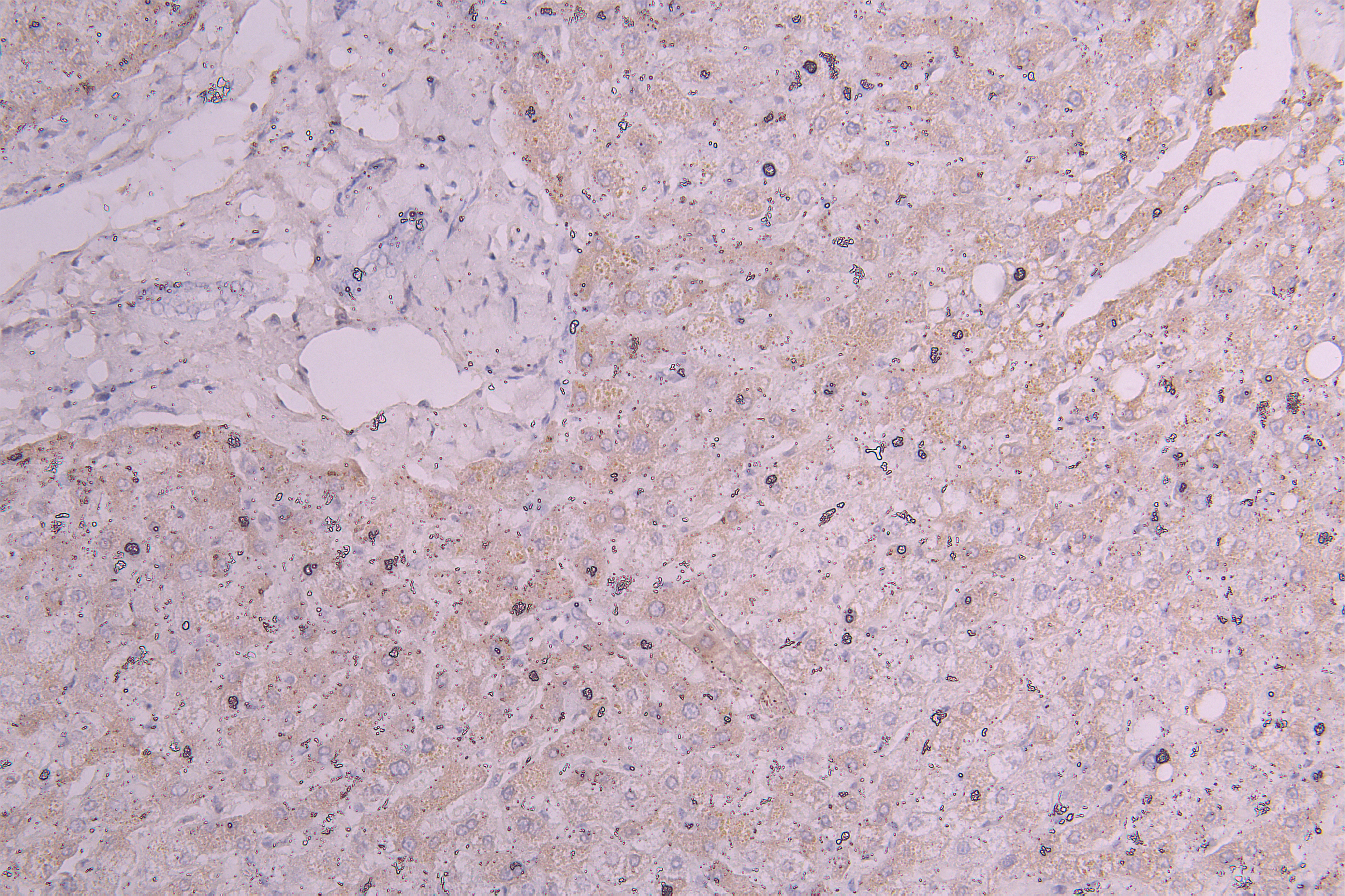 IHC image of CSB-RA010144MA1HU diluted at 1:300 and staining in paraffin-embedded human liver tissue performed on a Leica BondTM system. After dewaxing and hydration, antigen retrieval was mediated by high pressure in a citrate buffer (pH 6.0). Section was blocked with 10% normal goat serum 30min at RT. Then primary antibody (1% BSA) was incubated at 4°C overnight. The primary is detected by a Goat anti-Human IgG labeled by HRP and visualized using 0.05% DAB.