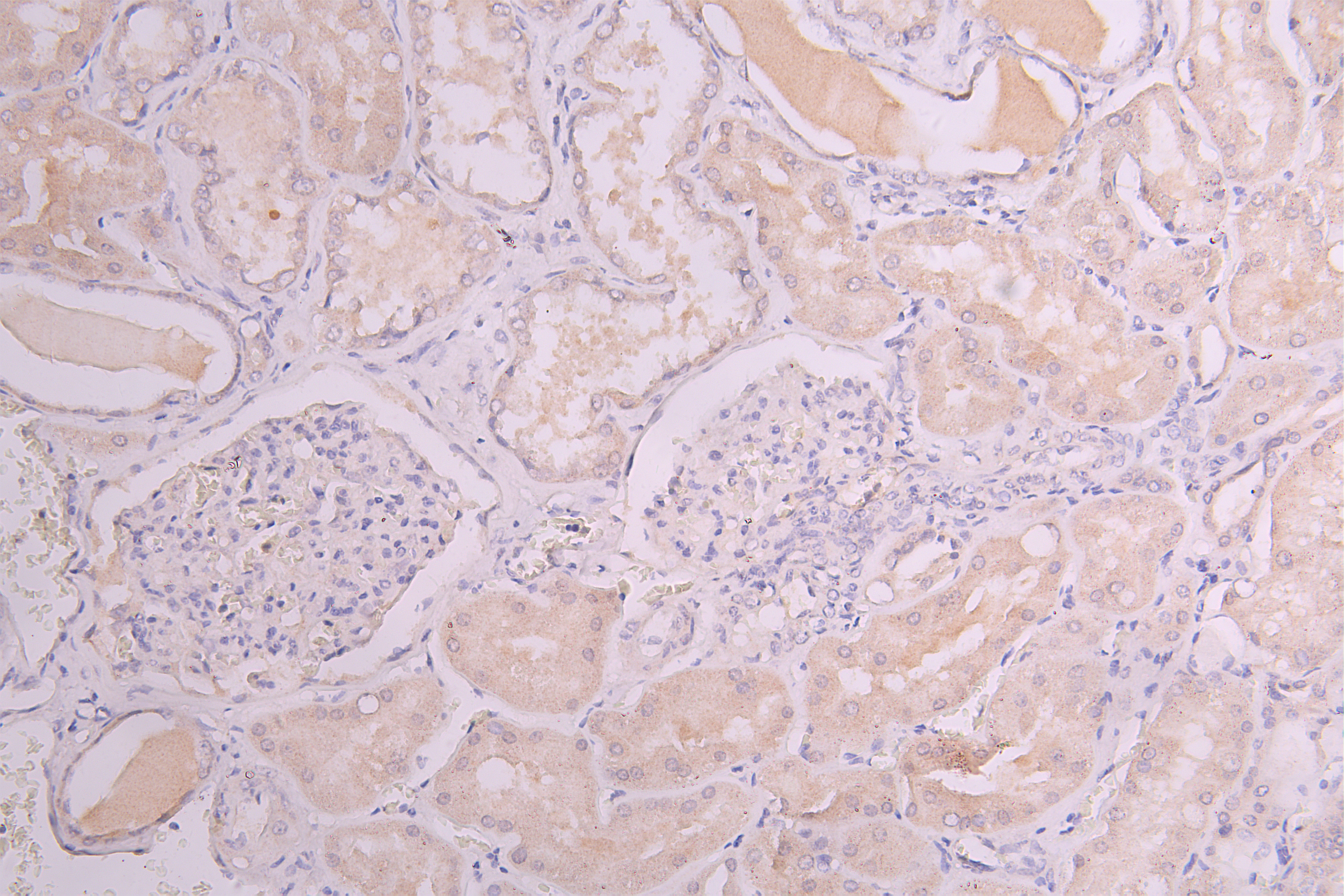 IHC image of CSB-RA010327MA1HU diluted at 1:100 and staining in paraffin-embedded human kidney tissue performed on a Leica BondTM system. After dewaxing and hydration, antigen retrieval was mediated by high pressure in a citrate buffer (pH 6.0). Section was blocked with 10% normal goat serum 30min at RT. Then primary antibody (1% BSA) was incubated at 4°C overnight. The primary is detected by a Goat anti-Human IgG labeled by HRP and visualized using 0.05% DAB.