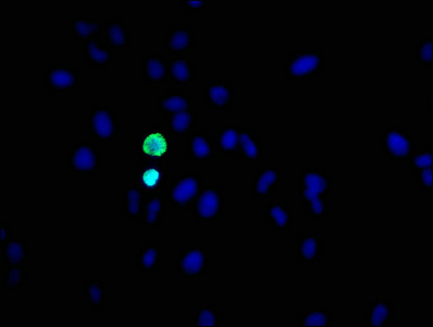 Immunofluorescence staining of Hela cells with CSB-RA010418A10phHU at 1:31,counter-stained with DAPI. The cells were fixed in 4% formaldehyde, permeabilized using 0.2% Triton X-100 and blocked in 10% normal Goat Serum. The cells were then incubated with the antibody overnight at 4°C.The secondary antibody was Alexa Fluor 488-congugated AffiniPure Goat Anti-Rabbit IgG (H+L).