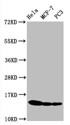 Western Blot Positive WB detected in Hela whole cell lysateCF-7 whole cell lysateC3 whole cell lysate All lanes Phospho-Histone H3.1(S10)antibody at 0.5microg/ml Secondary Goat polyclonal to rabbit IgG at 1/50000 dilution Predicted band size: 15 KDa Observed band size: 15 KDa