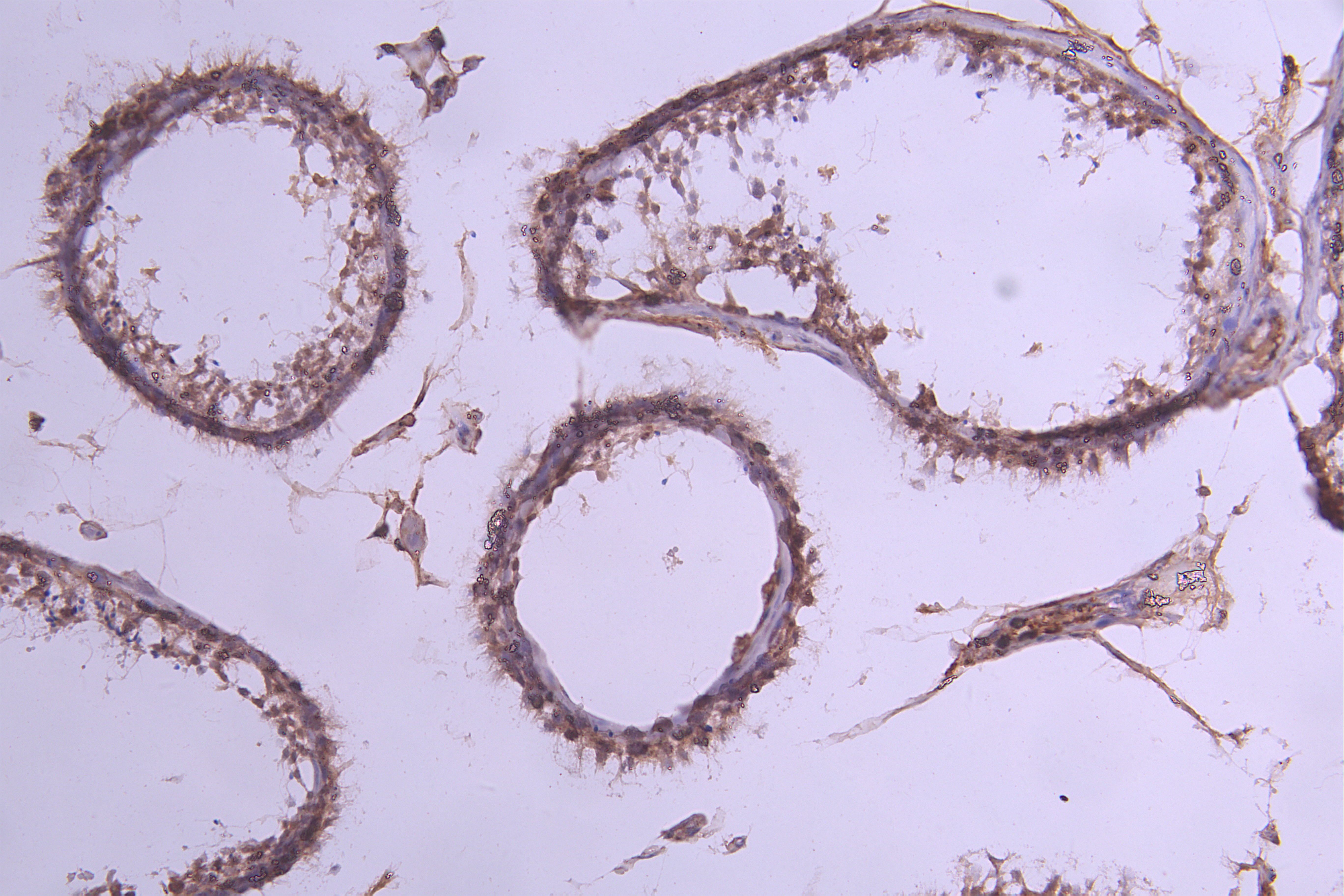 IHC image of CSB-RA011580MA1HU diluted at 1:300 and staining in paraffin-embedded human testis tissue performed on a Leica BondTM system. After dewaxing and hydration, antigen retrieval was mediated by high pressure in a citrate buffer (pH 6.0). Section was blocked with 10% normal goat serum 30min at RT. Then primary antibody (1% BSA) was incubated at 4°C overnight. The primary is detected by a Goat anti-Human IgG labeled by HRP and visualized using 0.05% DAB.