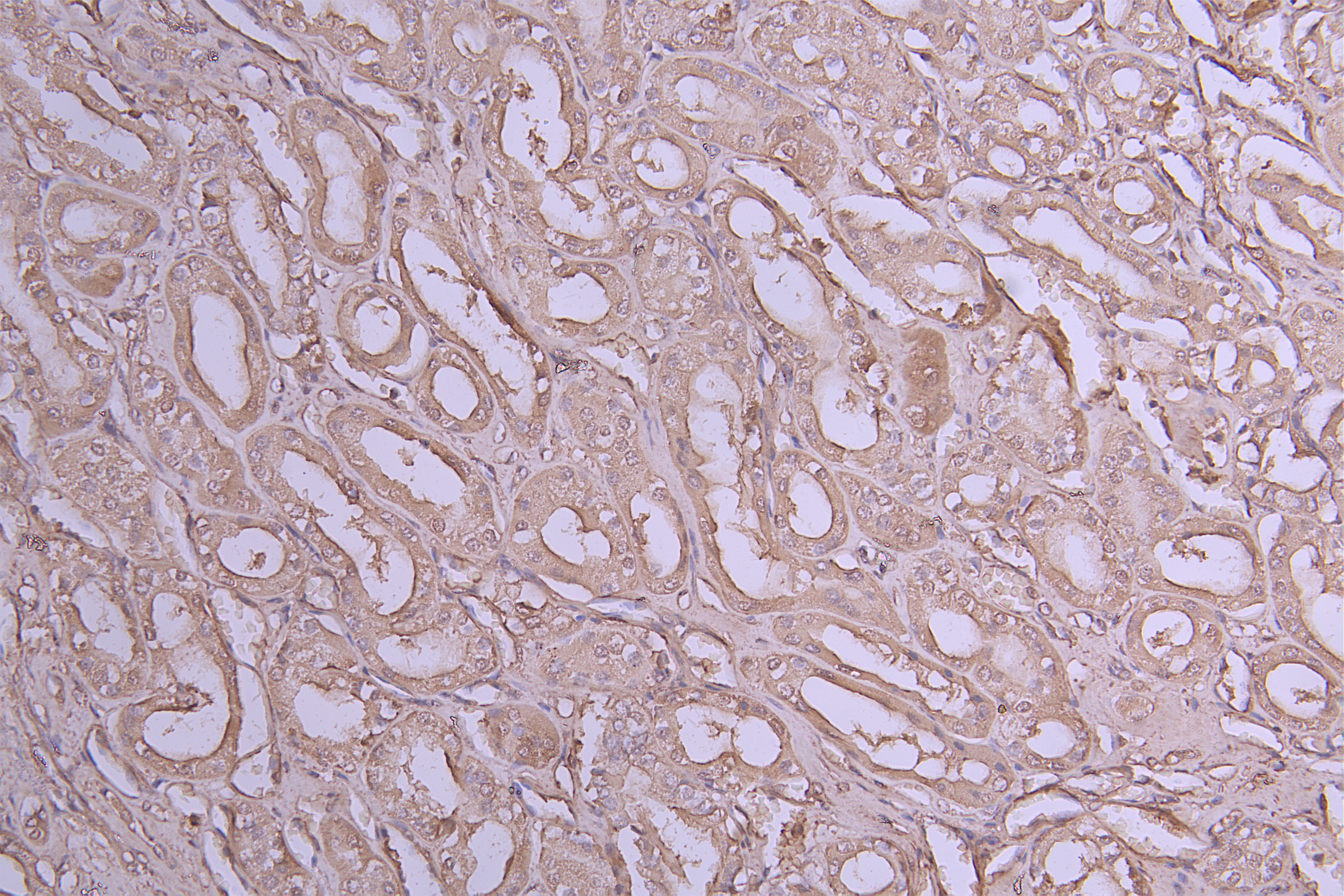 IHC image of CSB-RA011614MA1HU diluted at 1:100 and staining in paraffin-embedded human kidney tissue performed on a Leica BondTM system. After dewaxing and hydration, antigen retrieval was mediated by high pressure in a citrate buffer (pH 6.0). Section was blocked with 10% normal goat serum 30min at RT. Then primary antibody (1% BSA) was incubated at 4°C overnight. The primary is detected by a Goat anti-Human IgG labeled by HRP and visualized using 0.05% DAB.