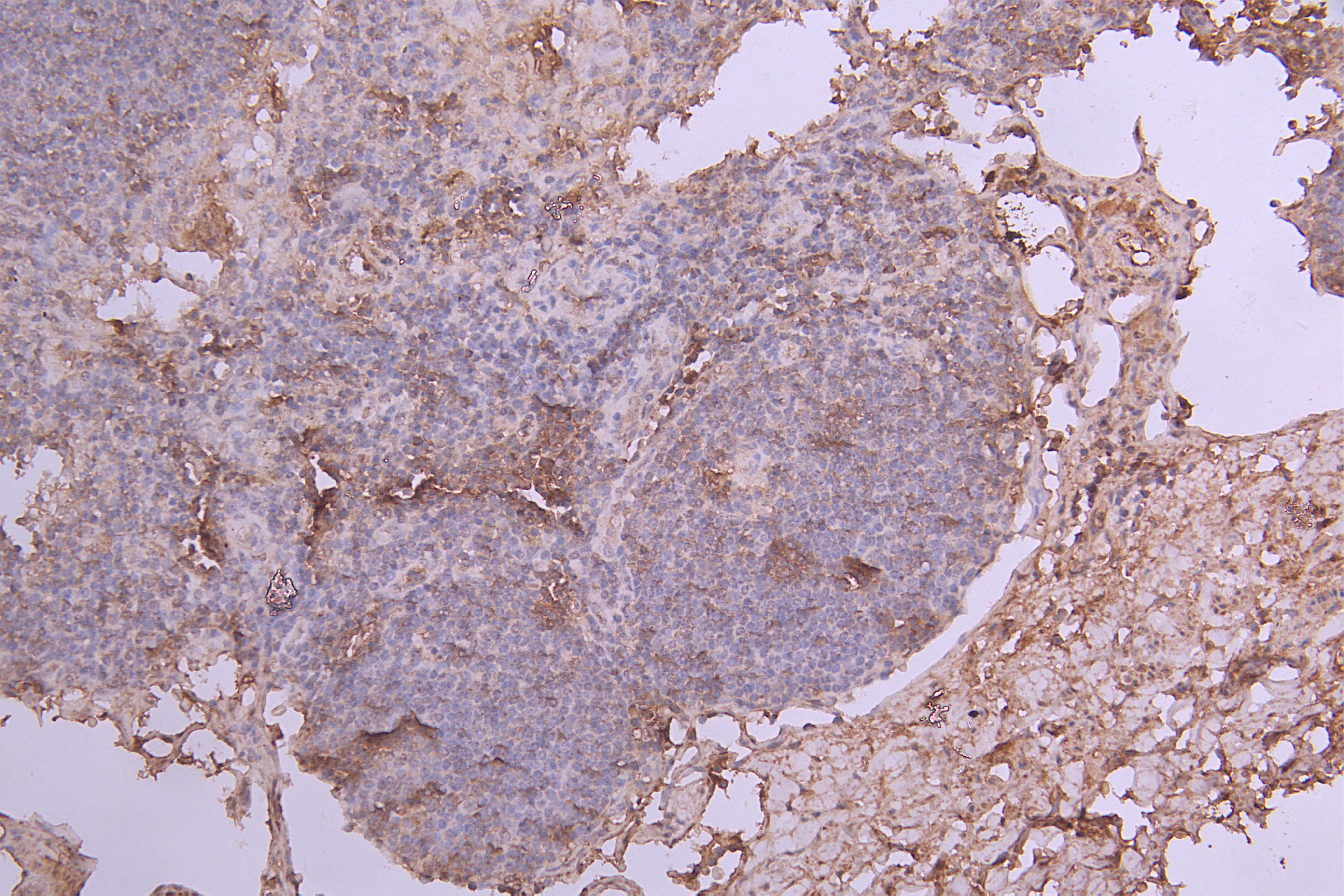 IHC image of CSB-RA011664MA2HU diluted at 1:100 and staining in paraffin-embedded human lymph node tissue performed on a Leica BondTM system. After dewaxing and hydration, antigen retrieval was mediated by high pressure in a citrate buffer (pH 6.0). Section was blocked with 10% normal goat serum 30min at RT. Then primary antibody (1% BSA) was incubated at 4°C overnight. The primary is detected by a Goat anti-Human IgG labeled by HRP and visualized using 0.05% DAB.