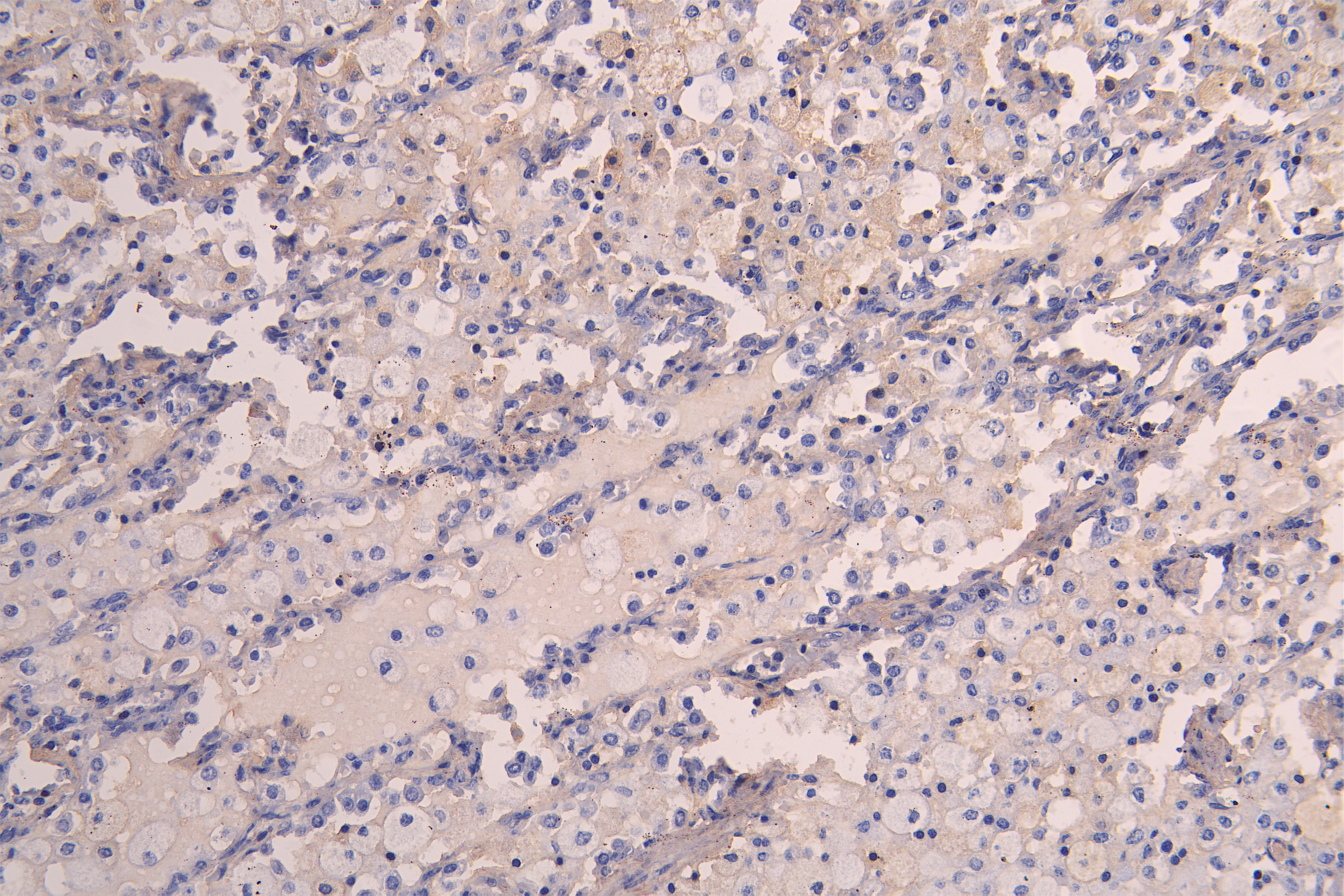 IHC image of CSB-RA012145MA1HU diluted at 1:200 and staining in paraffin-embedded human lung tissue performed on a Leica BondTM system. After dewaxing and hydration, antigen retrieval was mediated by high pressure in a citrate buffer (pH 6.0). Section was blocked with 10% normal goat serum 30min at RT. Then primary antibody (1% BSA) was incubated at 4°C overnight. The primary is detected by a Goat anti-human polymer IgG labeled by HRP and visualized using 0.05% DAB.