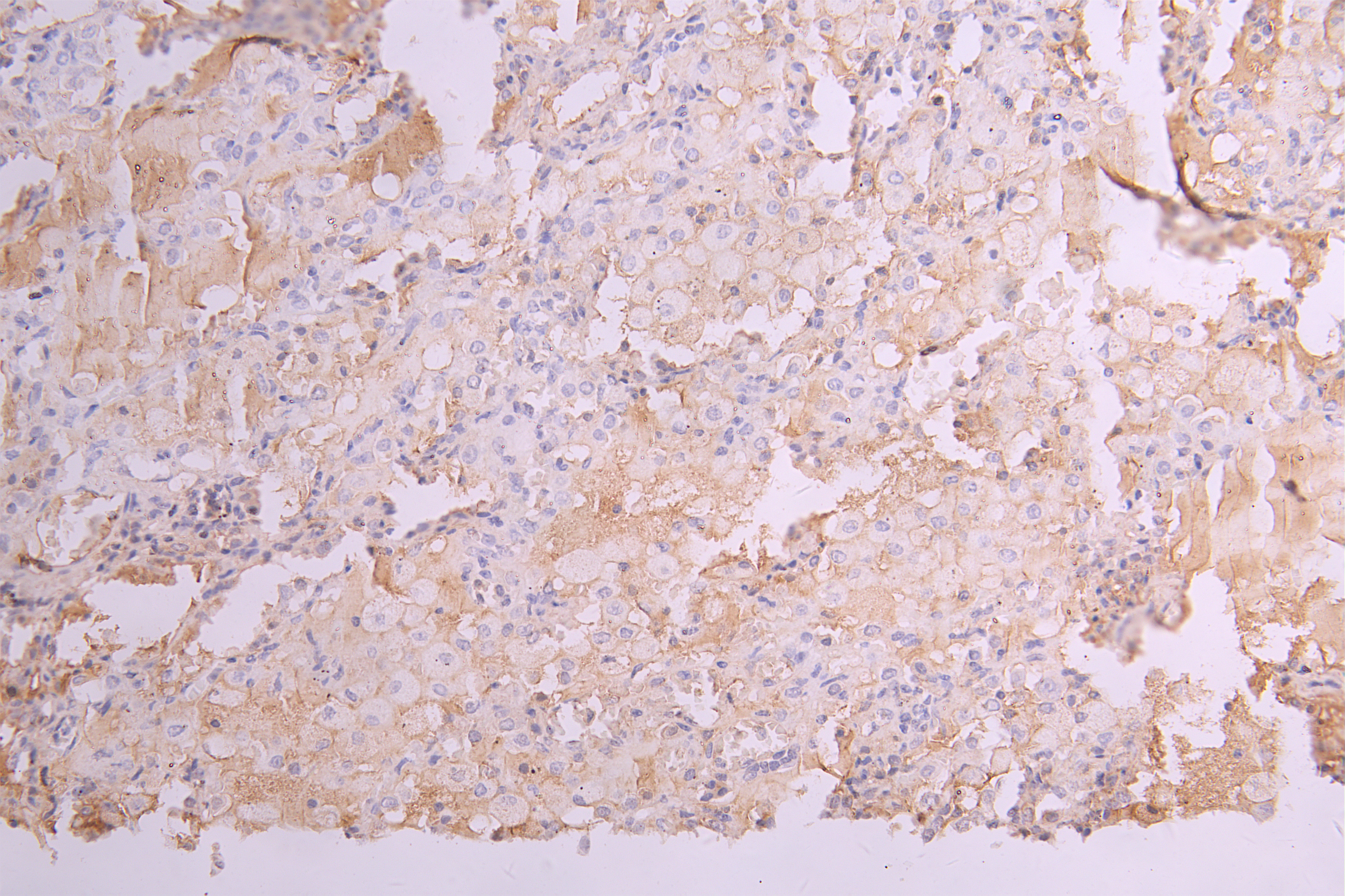 IHC image of CSB-RA012352MA1HU diluted at 1 : 100 and staining in paraffin-embedded human lung tissue performed on a Leica BondTM system. After dewaxing and hydration, antigen retrieval was mediated by high pressure in a citrate buffer (pH 6.0). Section was blocked with 10% normal goat serum 30min at RT. Then primary antibody (1% BSA) was incubated at 4°C overnight. The primary is detected by a Goat anti-human polymer IgG labeled by HRP and visualized using 0.05% DAB.