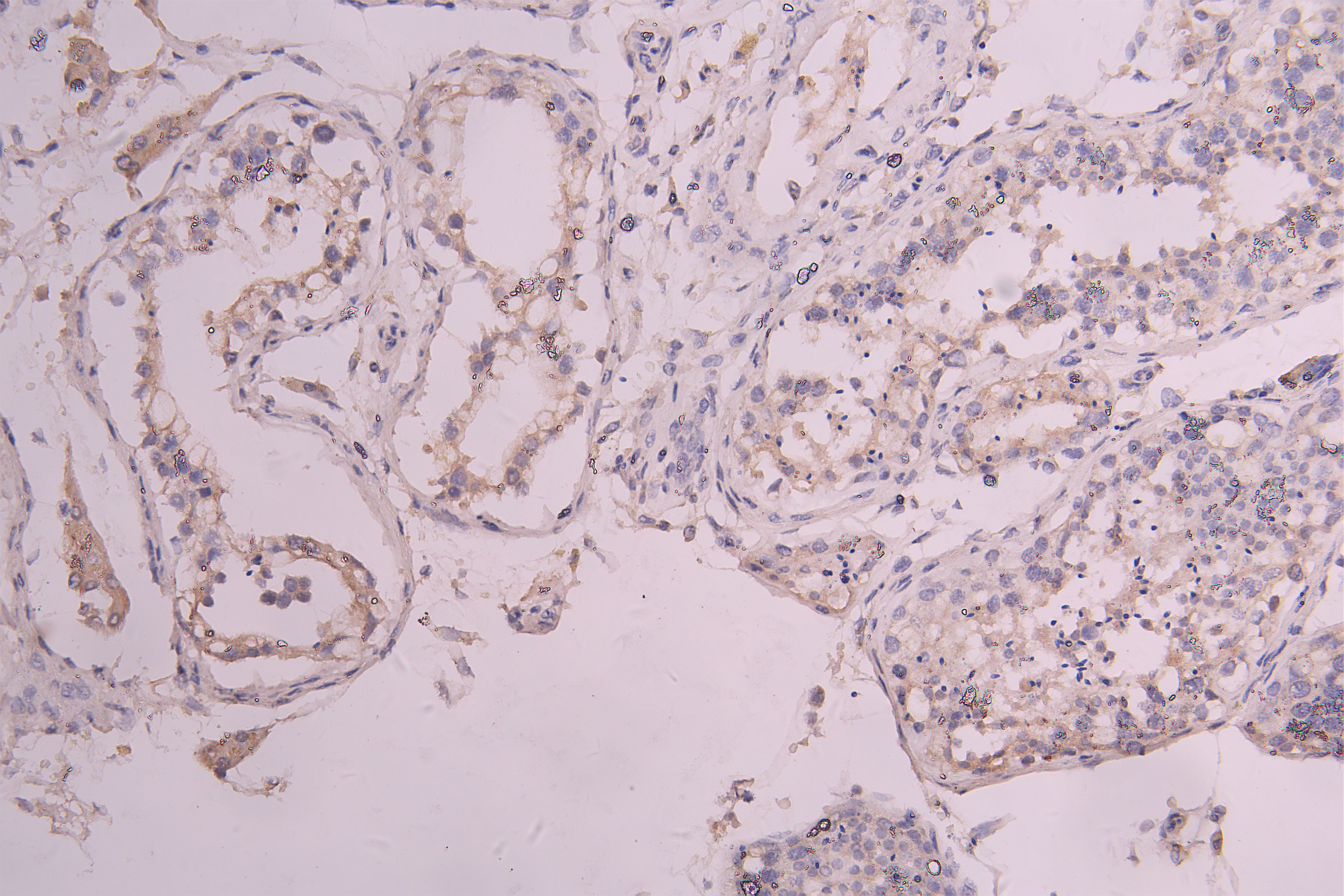 IHC image of CSB-RA012375MA1HU diluted at 1 : 100 and staining in paraffin-embedded human testis tissue performed on a Leica BondTM system. After dewaxing and hydration, antigen retrieval was mediated by high pressure in a citrate buffer (pH 6.0). Section was blocked with 10% normal goat serum 30min at RT. Then primary antibody (1% BSA) was incubated at 4°C overnight. The primary is detected by a Goat anti-human polymer IgG labeled by HRP and visualized using 0.05% DAB.