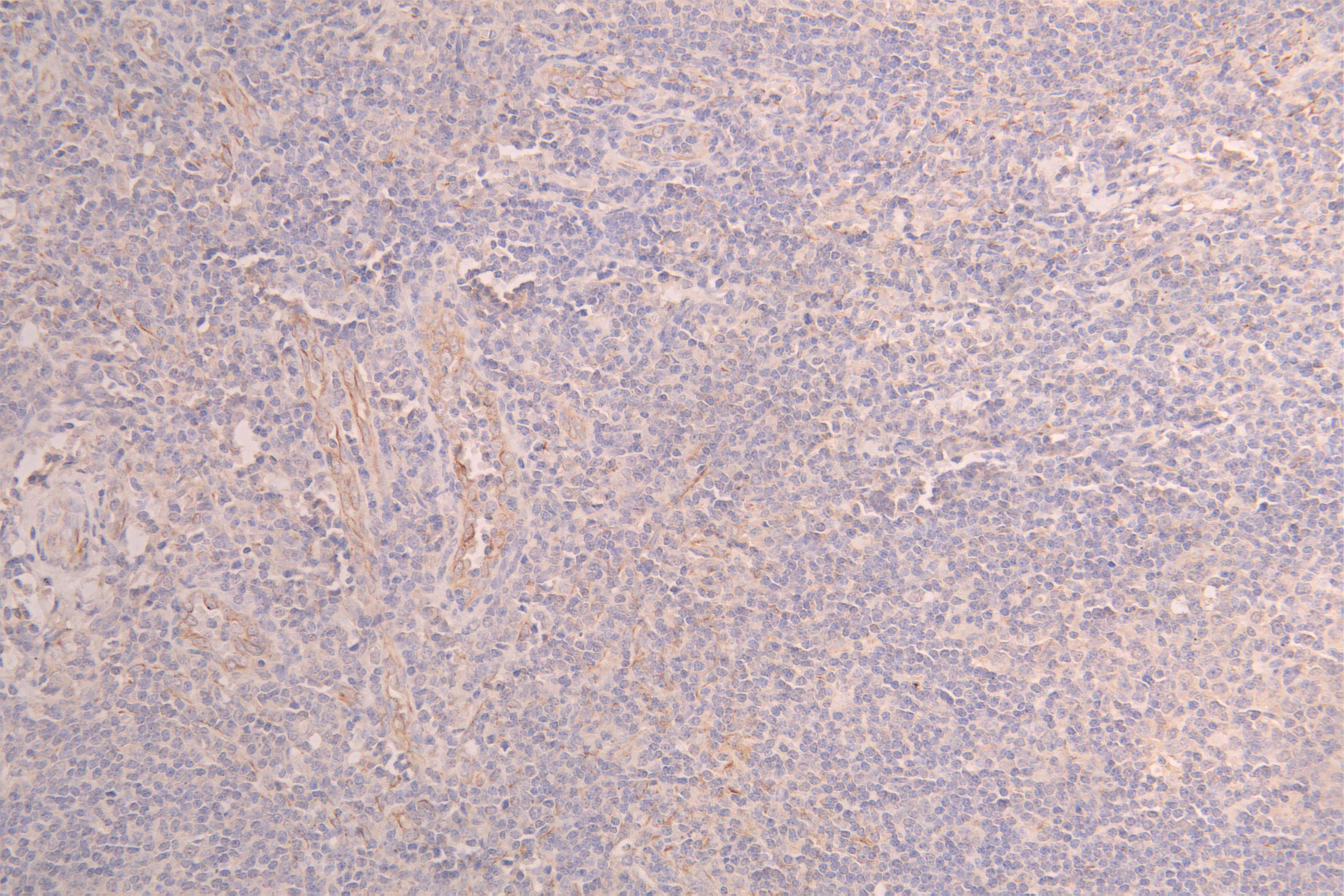 IHC image of CSB-RA012719MA1HU diluted at 1 : 100 and staining in paraffin-embedded human testis tissue performed on a Leica BondTM system. After dewaxing and hydration, antigen retrieval was mediated by high pressure in a citrate buffer (pH 6.0). Section was blocked with 10% normal goat serum 30min at RT. Then primary antibody (1% BSA) was incubated at 4°C overnight. The primary is detected by a Goat anti-human polymer IgG labeled by HRP and visualized using 0.05% DAB.