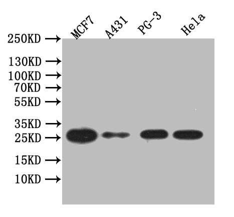 Western Blot Positive WB detected in: PC-3 whole cell lysate, MCF7 whole cell lysate, Hela whole cell lysate, A431 whole cell lysate All lanes: LGALS3 antibody at 1:1000 Secondary Goat polyclonal to human IgG at 1/50000 dilution Predicted band size: 26 kDa Observed band size: 26 kDa