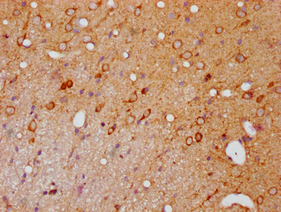 IHC image of CSB-RA017407A144phHU diluted at 1:100 and staining in paraffin-embedded rat brain tissue performed on a Leica BondTM system. After dewaxing and hydration, antigen retrieval was mediated by high pressure in a citrate buffer (pH 6.0). Section was blocked with 10% normal goat serum 30min at RT. Then primary antibody (1% BSA) was incubated at 4°C overnight. The primary is detected by a biotinylated secondary antibody and visualized using an HRP conjugated SP system.