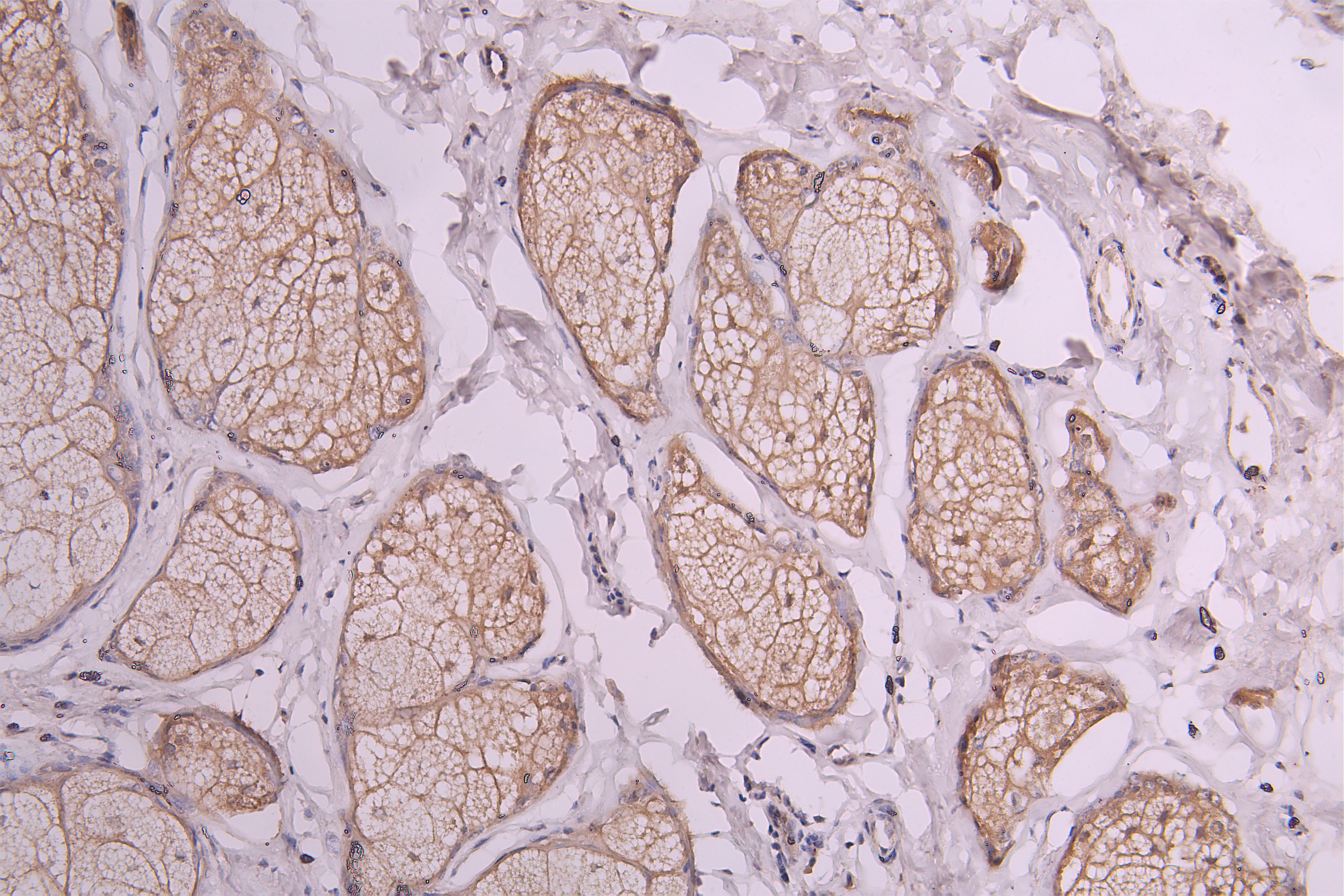 IHC image of CSB-RA020888MA1HU diluted at 1:300 and staining in paraffin-embedded human skin tissue performed on a Leica BondTM system. After dewaxing and hydration, antigen retrieval was mediated by high pressure in a citrate buffer (pH 6.0). Section was blocked with 10% normal goat serum 30min at RT. Then primary antibody (1% BSA) was incubated at 4°C overnight. The primary is detected by a Goat anti-Human IgG labeled by HRP and visualized using 0.05% DAB.