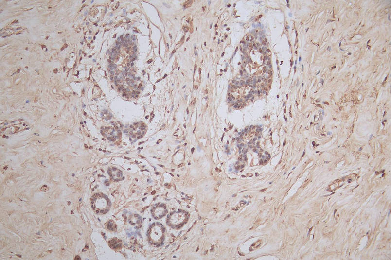 IHC image of CSB-RA022332MA1HU diluted at 1:50 and staining in paraffin-embedded human breast tissue performed on a Leica BondTM system. After dewaxing and hydration, antigen retrieval was mediated by high pressure in a citrate buffer (pH 6.0). Section was blocked with 10% normal goat serum 30min at RT. Then primary antibody (1% BSA) was incubated at 4°C overnight. The primary is detected by a Goat anti-mouse polymer IgG labeled by HRP and visualized using 0.05% DAB.