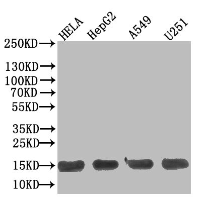 Western Blot Positive WB detected in: Hela whole cell lysate, HepG2 whole cell lysate, A549 whole cell lysate, U251 whole cell lysate All lanes: TNFRSF10B antibody at 1:500 Secondary Goat polyclonal to Human IgG at 1/50000 dilution Predicted band size: 13 kDa Observed band size: 13 kDa