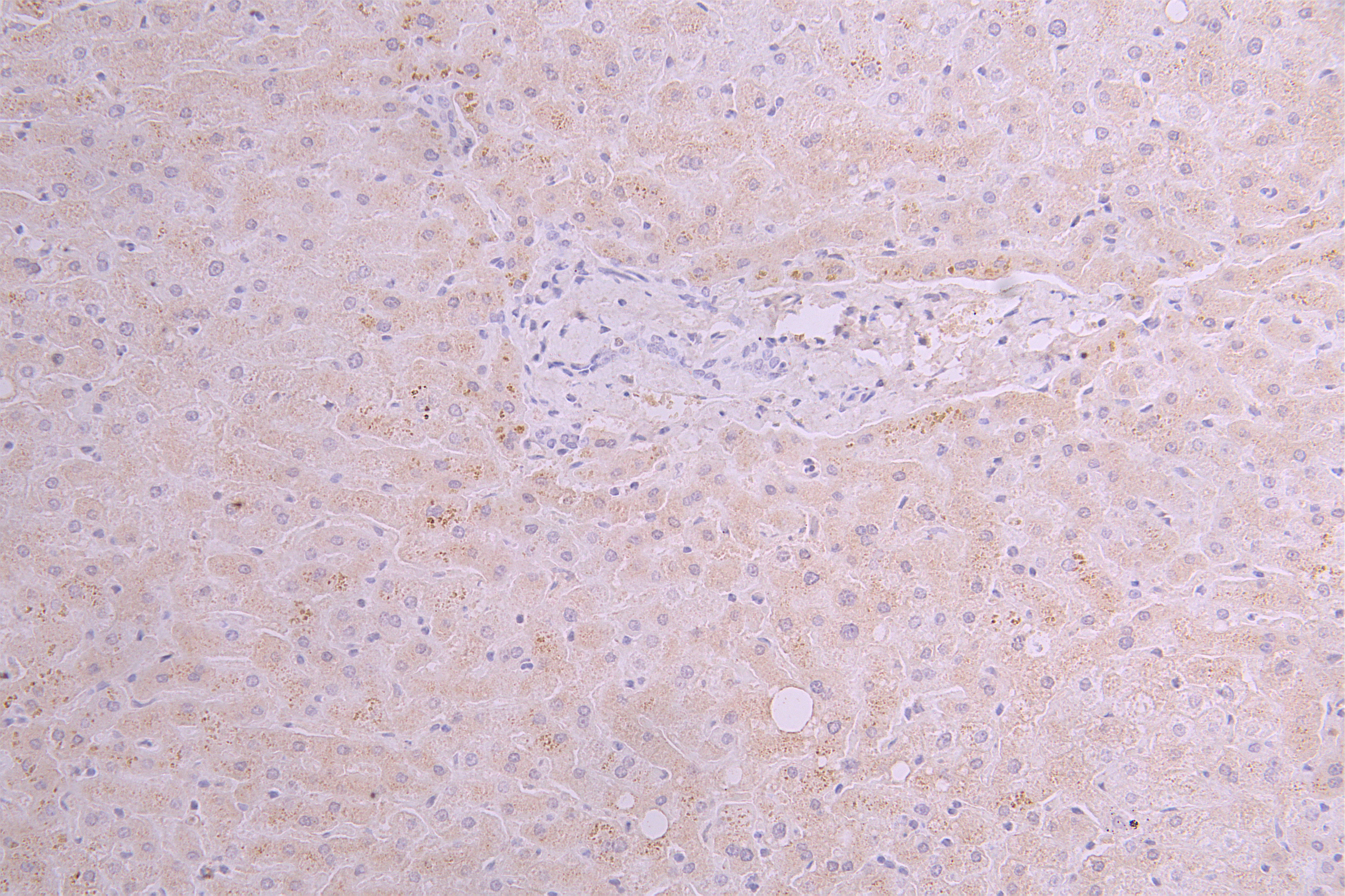 IHC image of CSB-RA025141MA1HU diluted at 1 : 100 and staining in paraffin-embedded human liver tissue performed on a Leica BondTM system. After dewaxing and hydration, antigen retrieval was mediated by high pressure in a citrate buffer (pH 6.0). Section was blocked with 10% normal goat serum 30min at RT. Then primary antibody (1% BSA) was incubated at 4°C overnight. The primary is detected by a Goat anti-human polymer IgG labeled by HRP and visualized using 0.05% DAB.