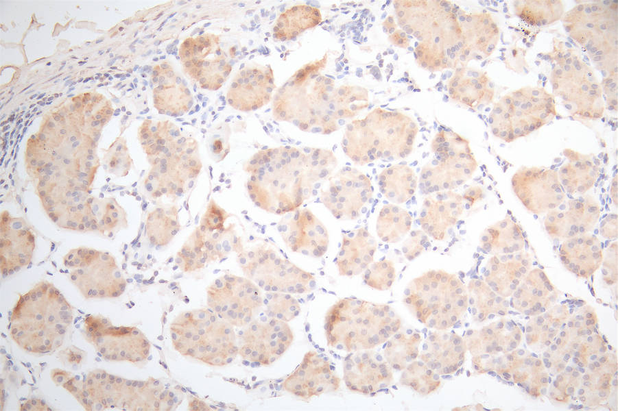 IHC image of CSB-RA025440MA1HU diluted at 1:300 and staining in paraffin-embedded human stomach tissue performed on a Leica BondTM system. After dewaxing and hydration, antigen retrieval was mediated by high pressure in a citrate buffer (pH 6.0). Section was blocked with 10% normal goat serum 30min at RT. Then primary antibody (1% BSA) was incubated at 4°C overnight. The primary is detected by a Goat anti-Mouse IgG labeled by HRP and visualized using 0.05% DAB.