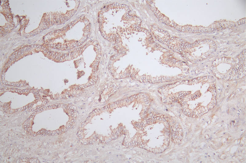 IHC image of CSB-RA037143A0HU diluted at 1:100 and staining in paraffin-embedded human prostate tissue performed on a Leica BondTM system. After dewaxing and hydration, antigen retrieval was mediated by high pressure in a citrate buffer (pH 6.0). Section was blocked with 10% normal goat serum 30min at RT. Then primary antibody (1% BSA) was incubated at 4°C overnight. The primary is detected by a Goat anti-rabbit polymer IgG labeled by HRP and visualized using 0.77% DAB.