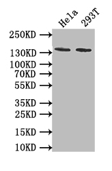 Western Blot Positive WB detected in: Hela whole cell lysate, 293T whole cell lysate All lanes: EBI3 antibody at 1:1000 Secondary Goat polyclonal to rabbit IgG at 1/50000 dilution Predicted band size: 140 kDa Observed band size: 140 kDa