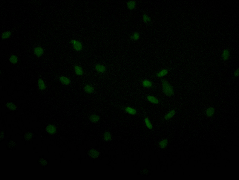 Immunofluorescence staining of MCF-7 with CSB-RA067358A0HU at 1:30, counter-stained with DAPI. The cells were fixed in 4% formaldehyde and blocked in 10% normal Goat Serum. The cells were then incubated with the antibody overnight at 4°C. The secondary antibody was Alexa Fluor 493-congugated AffiniPure Goat Anti-Rabbit IgG(H+L).